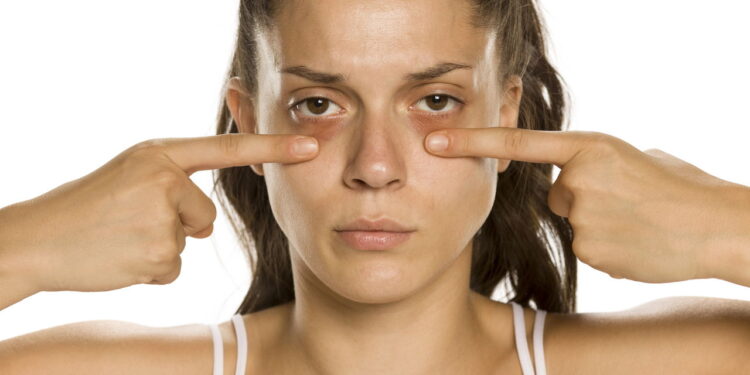 Rotina simples que acaba com olheiras e rejuvenesce o olhar