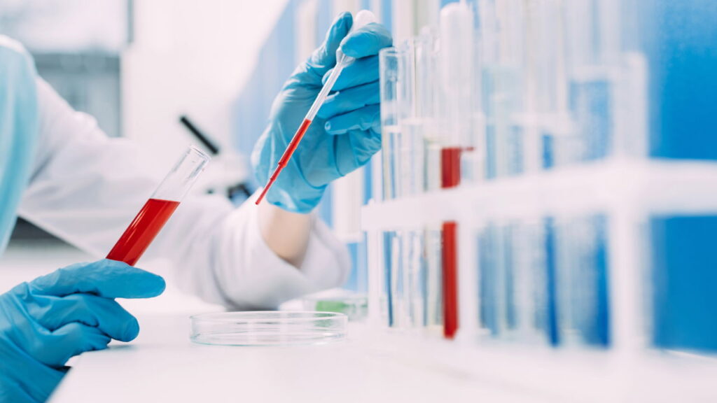 Sangue dourado, o fenômeno raríssimo que intriga cientistas e médicos