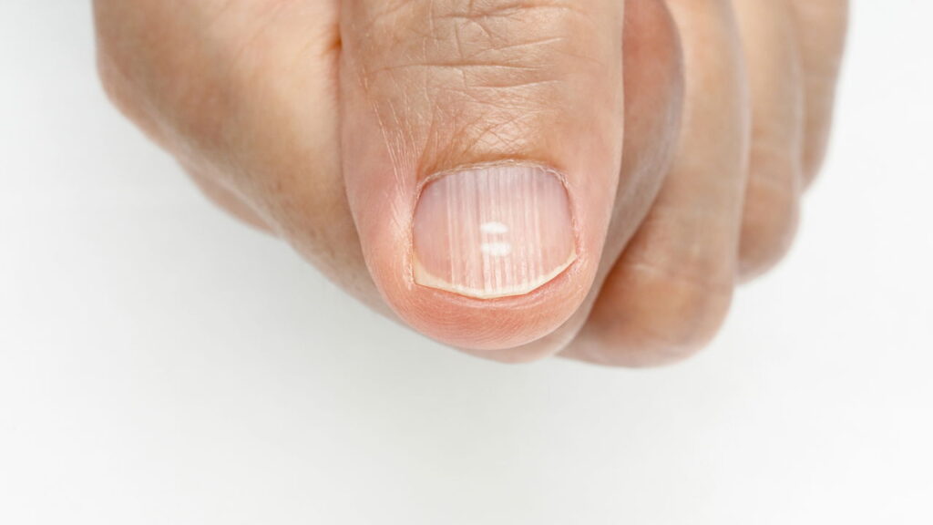Unhas