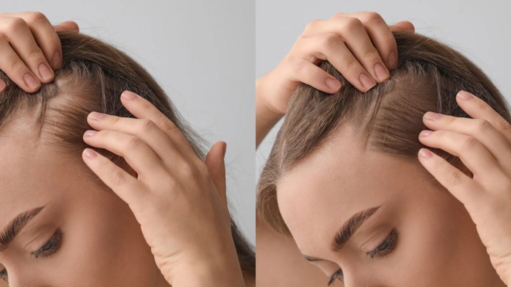 Cabelo
