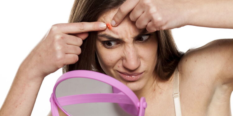 6 formas simples de manter sua pele limpa e livre das espinhas