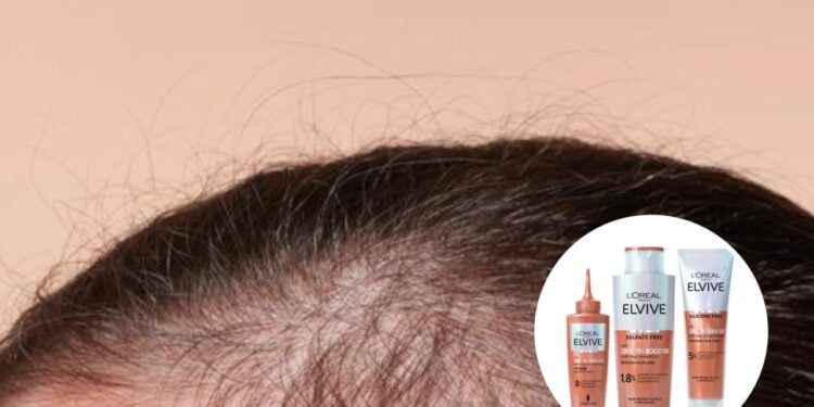 5 shampoos que acabam com a queda e fazem o cabelo crescer