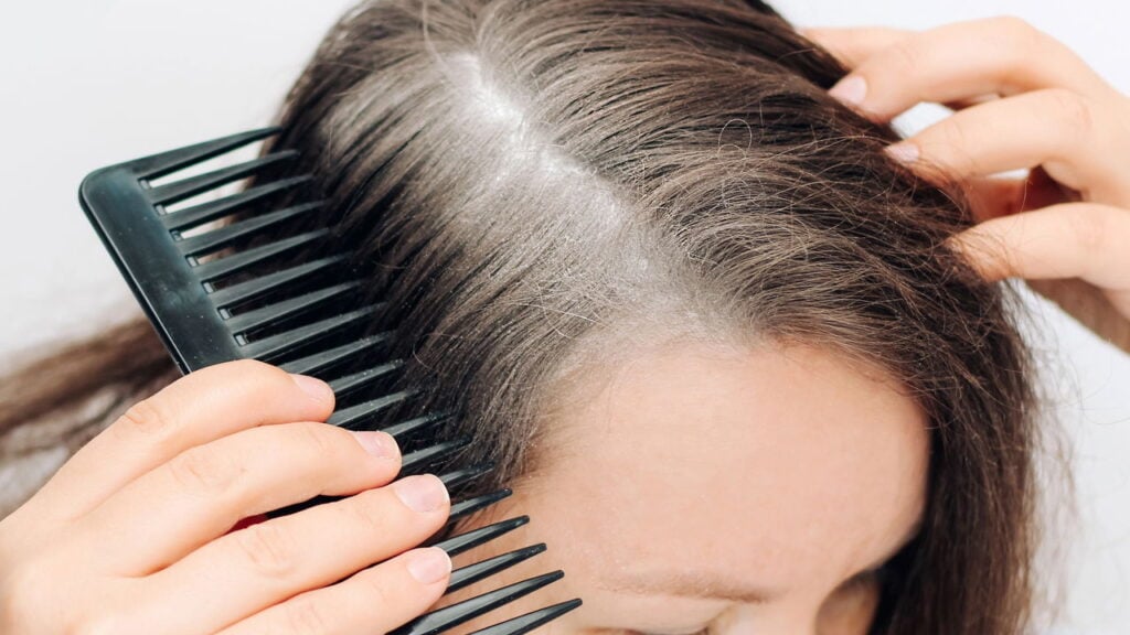 shampoo tonalizante